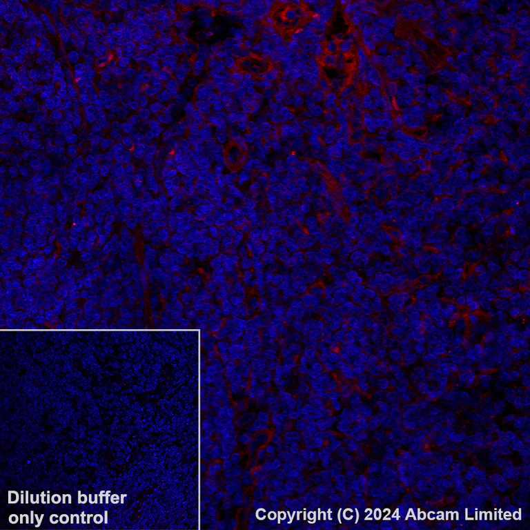 Immunohistochemistry (Formalin/PFA-fixed paraffin-embedded sections) - Alexa Fluor® 647 Anti-FCRL4 antibody [EPR21961] (AB320114)