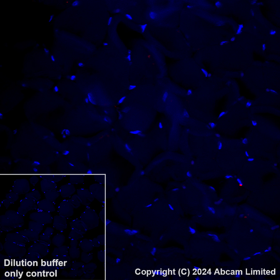 Immunohistochemistry (Formalin/PFA-fixed paraffin-embedded sections) - Alexa Fluor® 647 Anti-FCRL4 antibody [EPR21961] (AB320114), expandable thumbnail