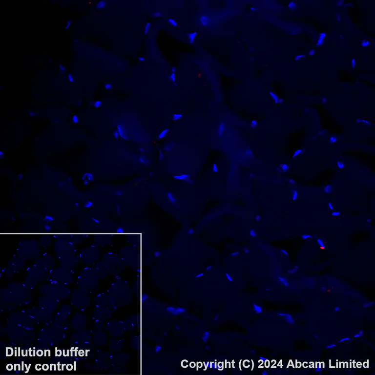 Immunohistochemistry (Formalin/PFA-fixed paraffin-embedded sections) - Alexa Fluor® 647 Anti-FCRL4 antibody [EPR21961] (AB320114)