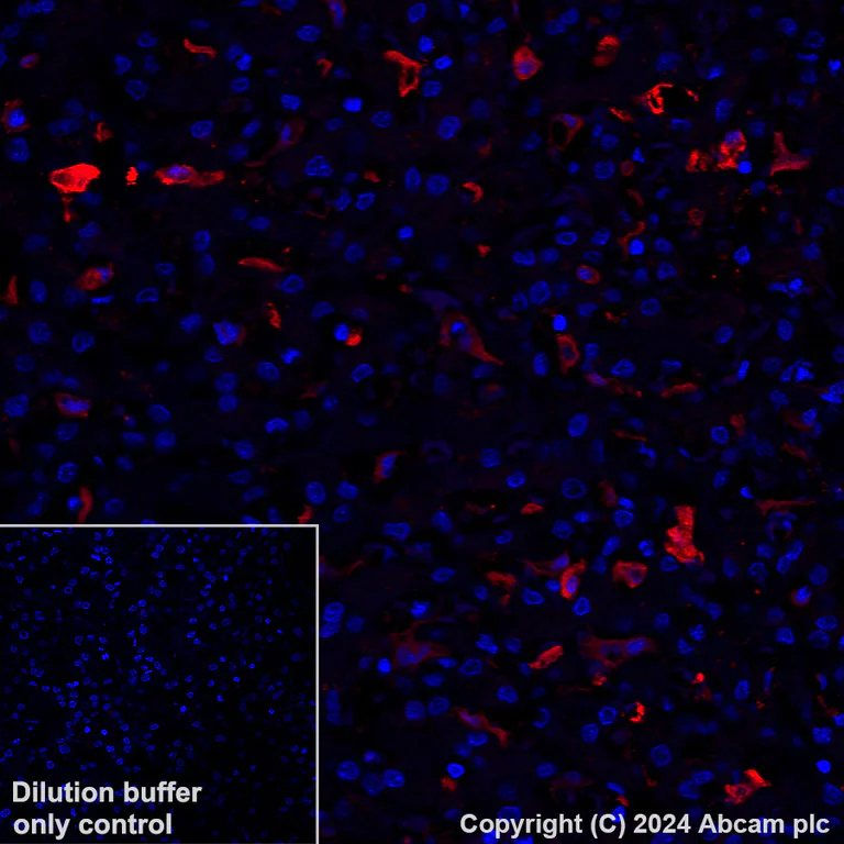 Immunohistochemistry (Formalin/PFA-fixed paraffin-embedded sections) - Alexa Fluor® 647 Anti-Ferritin Light Chain antibody [EPR26117-110] (AB318240)