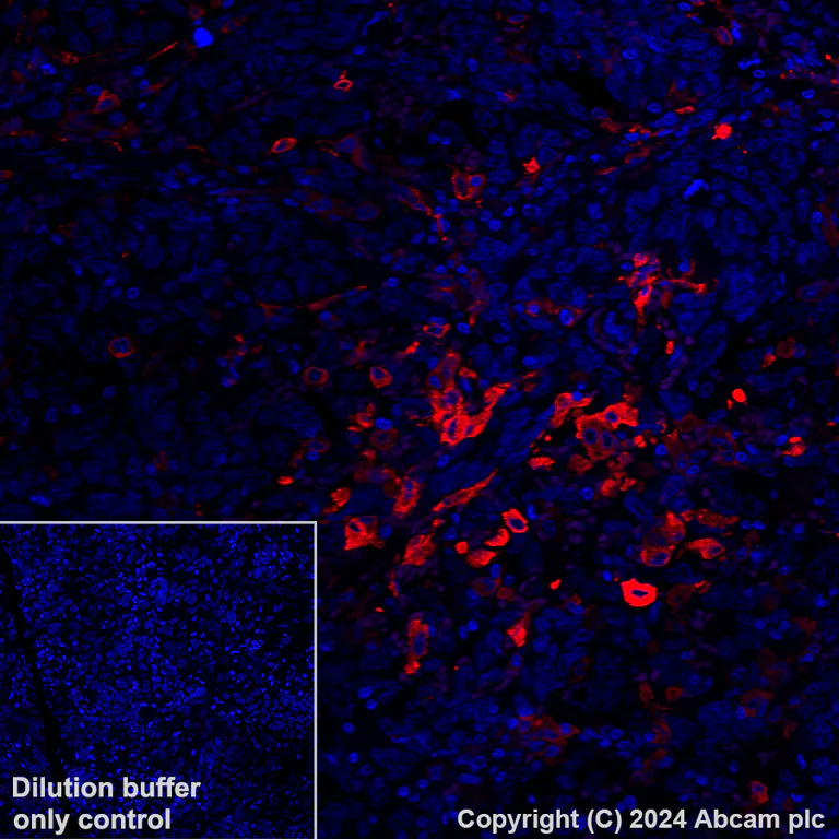 Immunohistochemistry (Formalin/PFA-fixed paraffin-embedded sections) - Alexa Fluor® 647 Anti-Ferritin Light Chain antibody [EPR26117-110] (AB318240)