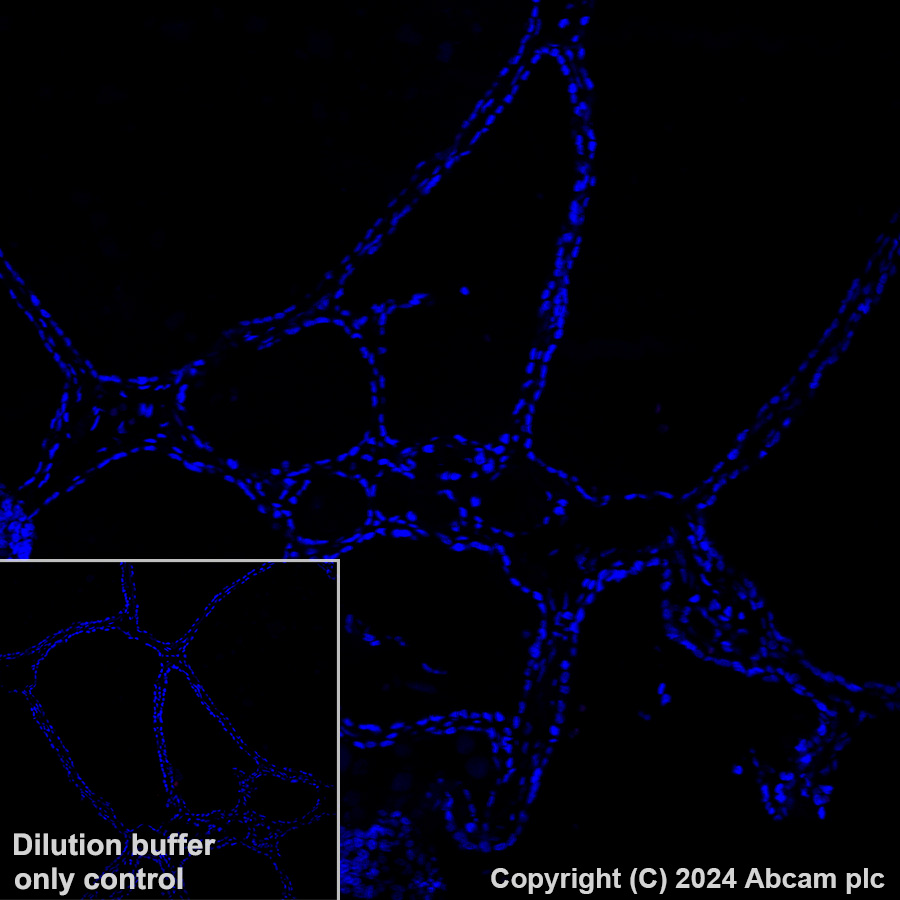 Immunohistochemistry (Formalin/PFA-fixed paraffin-embedded sections) - Alexa Fluor® 647 Anti-Ferritin Light Chain antibody [EPR26117-110] (AB318240)