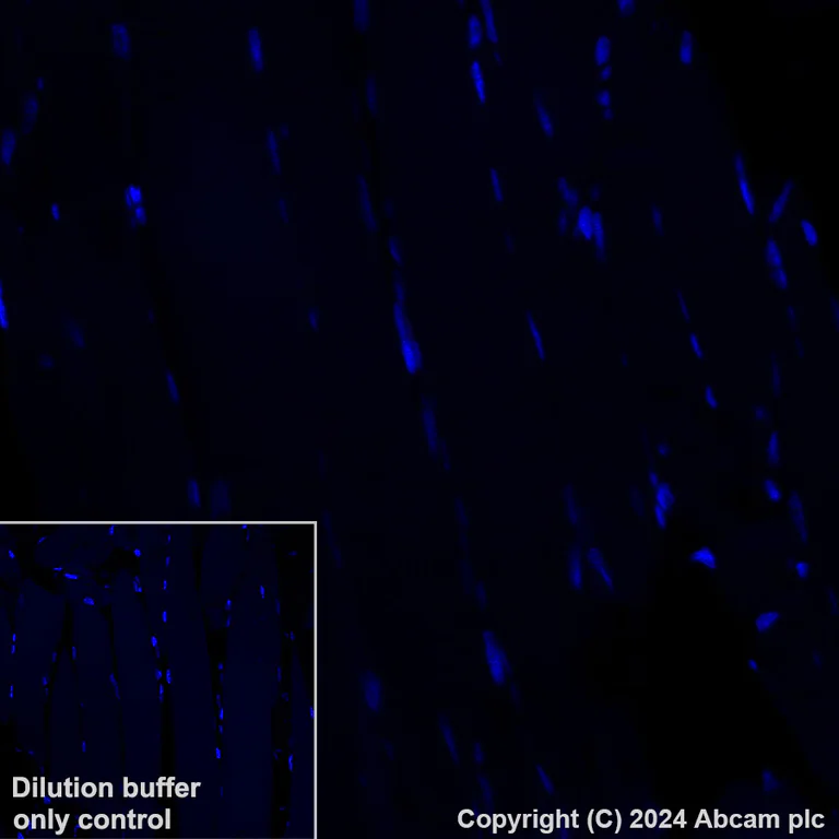 Immunohistochemistry (Formalin/PFA-fixed paraffin-embedded sections) - Alexa Fluor® 647 Anti-Ferritin Light Chain antibody [EPR26117-110] (AB318240)