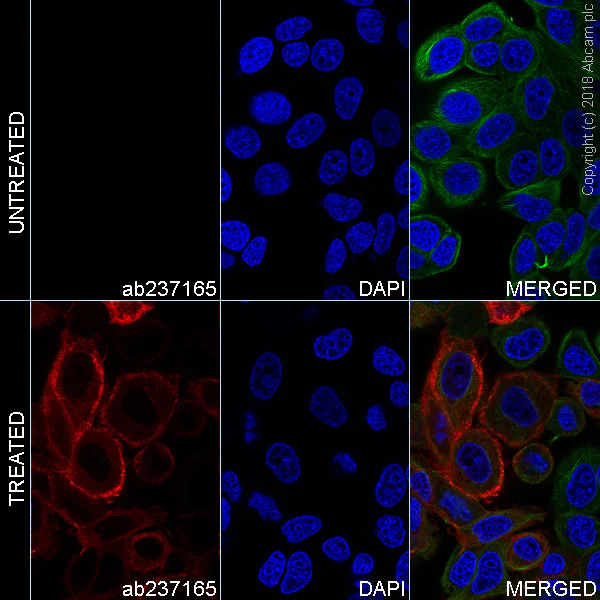 Immunocytochemistry/ Immunofluorescence - Alexa Fluor® 647 Anti-FGFR3 (phospho Y724) antibody [EPR2281(3)] (AB237165)