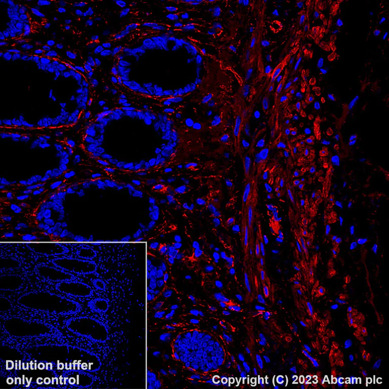 Immunohistochemistry (Formalin/PFA-fixed paraffin-embedded sections) - Alexa Fluor® 647 Anti-Fibronectin antibody [EPR23110-46] (AB313350)