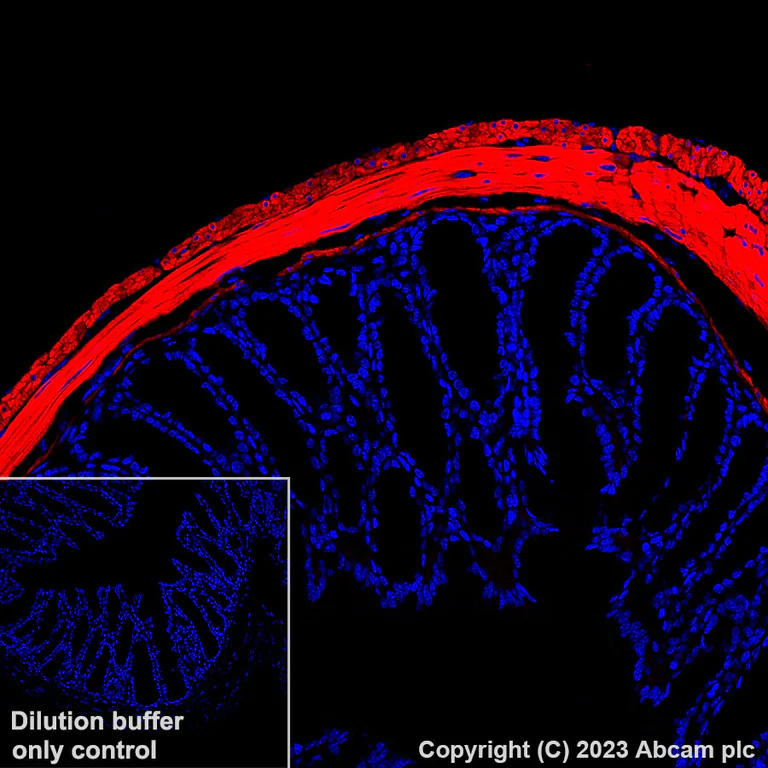Immunohistochemistry (Formalin/PFA-fixed paraffin-embedded sections) - Alexa Fluor® 647 Anti-Fibronectin antibody [EPR23110-46] (AB313350)