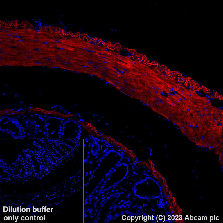 Immunohistochemistry (Formalin/PFA-fixed paraffin-embedded sections) - Alexa Fluor® 647 Anti-Fibronectin antibody [EPR23110-46] (AB313350)