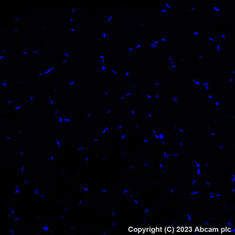 Immunohistochemistry (Formalin/PFA-fixed paraffin-embedded sections) - Alexa Fluor® 647 Anti-Fibronectin antibody [EPR23110-46] (AB313350)