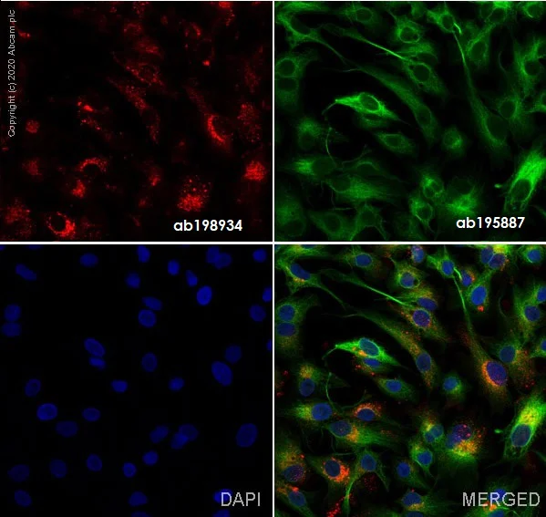 Immunocytochemistry - Alexa Fluor® 647 Anti-Fibronectin antibody [F1] (AB198934)