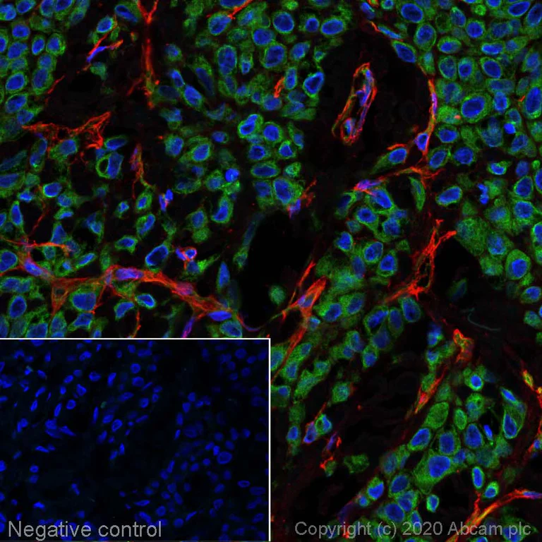Immunohistochemistry (Formalin/PFA-fixed paraffin-embedded sections) - Alexa Fluor® 647 Anti-Fibronectin antibody [F1] (AB198934)