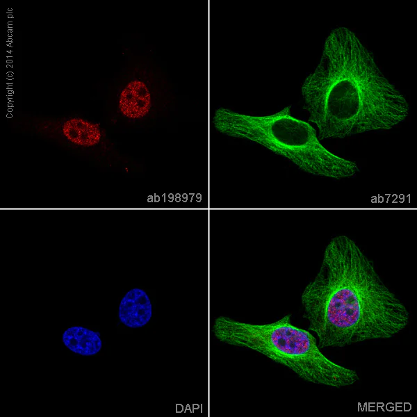 Immunocytochemistry/ Immunofluorescence - Alexa Fluor® 647 Anti-FKBP51 antibody [EPR6617] (AB198979)