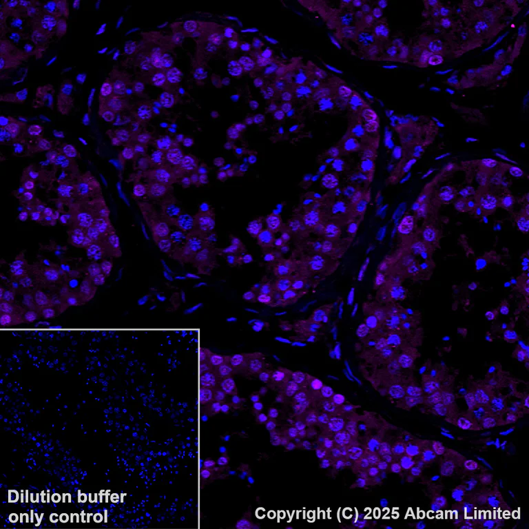 Immunohistochemistry (Formalin/PFA-fixed paraffin-embedded sections) - Alexa Fluor® 647 Anti-FKBP51 antibody [EPR6617] (AB198979)