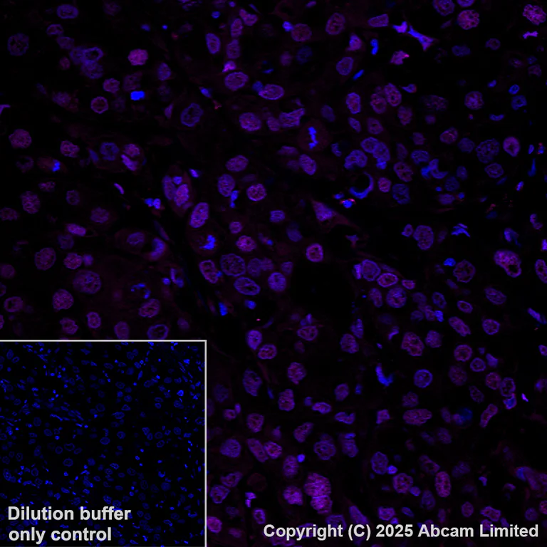 Immunohistochemistry (Formalin/PFA-fixed paraffin-embedded sections) - Alexa Fluor® 647 Anti-FKBP51 antibody [EPR6617] (AB198979)