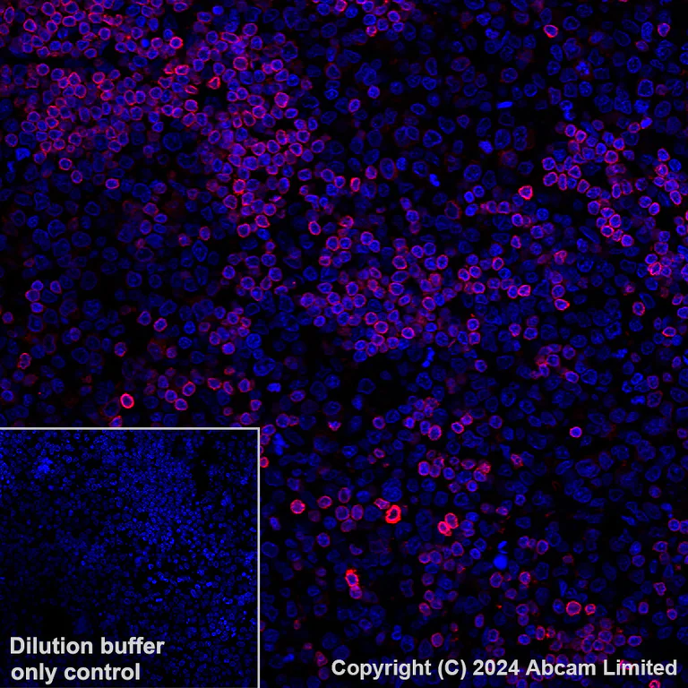 Immunohistochemistry (Formalin/PFA-fixed paraffin-embedded sections) - Alexa Fluor® 647 Anti-FLAP antibody [EPR27505-52] (AB319019)