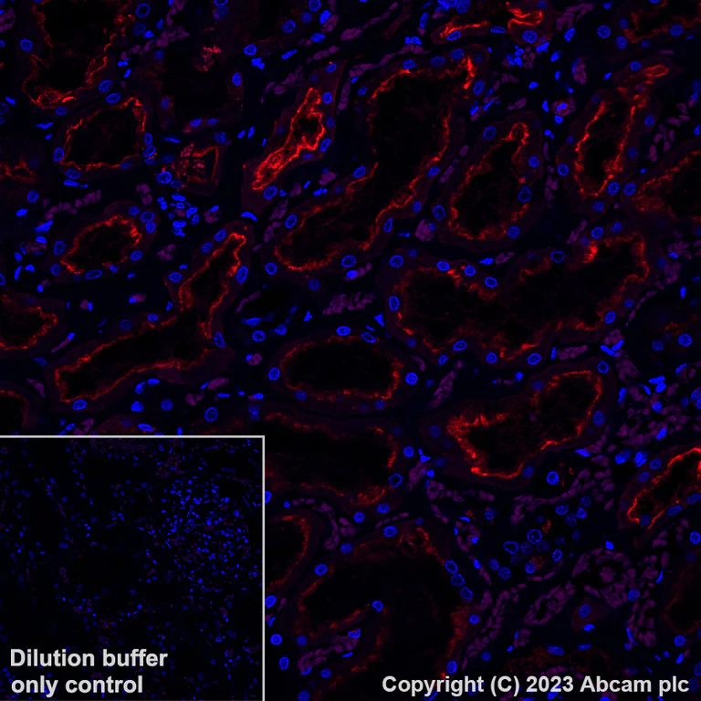 Immunohistochemistry (Formalin/PFA-fixed paraffin-embedded sections) - Alexa Fluor® 647 Anti-Folate Binding Protein/FBP antibody [EPR20277] (AB309500)