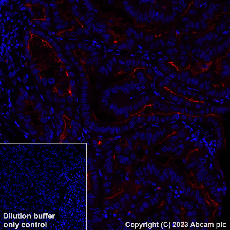 Immunohistochemistry (Formalin/PFA-fixed paraffin-embedded sections) - Alexa Fluor® 647 Anti-Folate Binding Protein/FBP antibody [EPR20277] (AB309500)