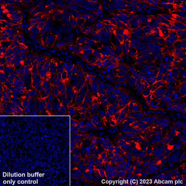 Immunohistochemistry (Formalin/PFA-fixed paraffin-embedded sections) - Alexa Fluor® 647 Anti-Folate Binding Protein/FBP antibody [EPR20277] (AB309500)