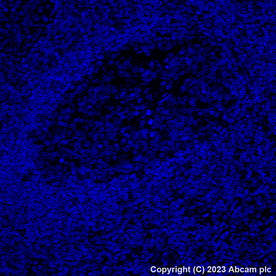 Immunohistochemistry (Formalin/PFA-fixed paraffin-embedded sections) - Alexa Fluor® 647 Anti-Folate Binding Protein/FBP antibody [EPR20277] (AB309500)