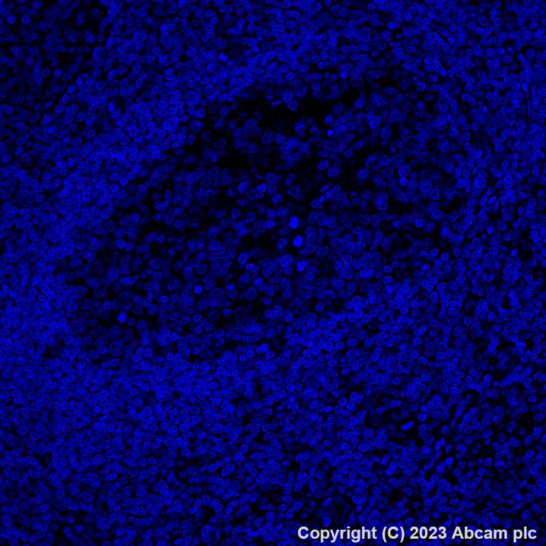 Immunohistochemistry (Formalin/PFA-fixed paraffin-embedded sections) - Alexa Fluor® 647 Anti-Folate Binding Protein/FBP antibody [EPR20277] (AB309500)