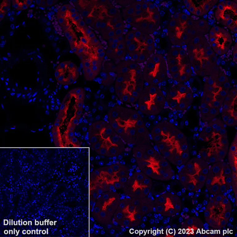 Immunohistochemistry (Formalin/PFA-fixed paraffin-embedded sections) - Alexa Fluor® 647 Anti-Folate Binding Protein/FBP antibody [EPR20277] (AB309500)