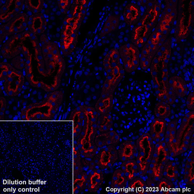 Immunohistochemistry (Formalin/PFA-fixed paraffin-embedded sections) - Alexa Fluor® 647 Anti-Folate Binding Protein/FBP antibody [EPR20277] (AB309500)
