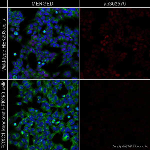Immunocytochemistry/ Immunofluorescence - Alexa Fluor® 647 Anti-FOXC1 antibody [EPR20685] (AB303579)