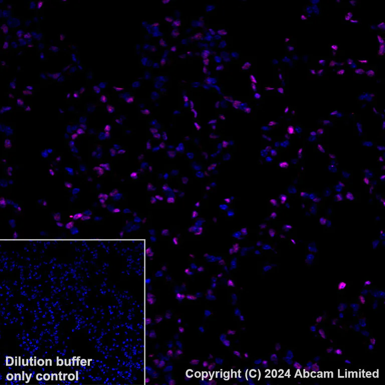 Immunohistochemistry (Formalin/PFA-fixed paraffin-embedded sections) - Alexa Fluor® 647 Anti-FOXF1 antibody [EPR27368-79] (AB320702)