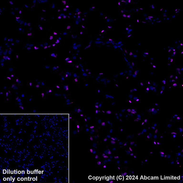 Immunohistochemistry (Formalin/PFA-fixed paraffin-embedded sections) - Alexa Fluor® 647 Anti-FOXF1 antibody [EPR27368-79] (AB320702)