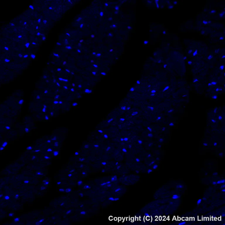 Immunohistochemistry (Formalin/PFA-fixed paraffin-embedded sections) - Alexa Fluor® 647 Anti-FOXF1 antibody [EPR27368-79] (AB320702)