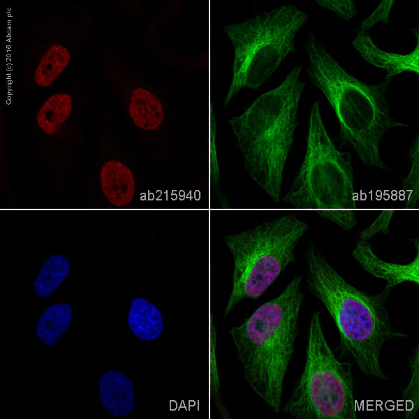 Immunocytochemistry/ Immunofluorescence - Alexa Fluor® 647 Anti-FOXF1 antibody [EPR7971] (AB215940)