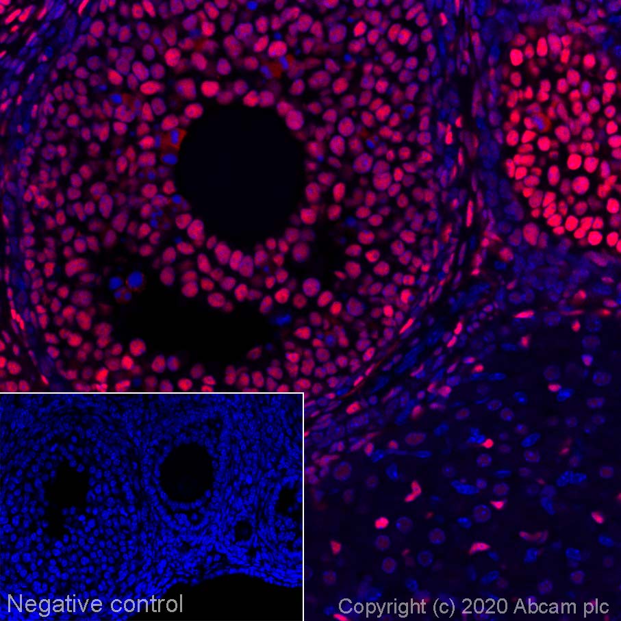 Immunohistochemistry (Formalin/PFA-fixed paraffin-embedded sections) - Alexa Fluor® 647 Anti-FOXL2 antibody [EPR23523-68] (AB275153)