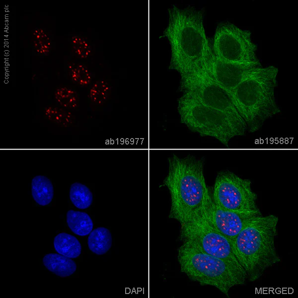 Immunocytochemistry/ Immunofluorescence - Alexa Fluor® 647 Anti-FOXP1 antibody [EPR4113] (AB196977)