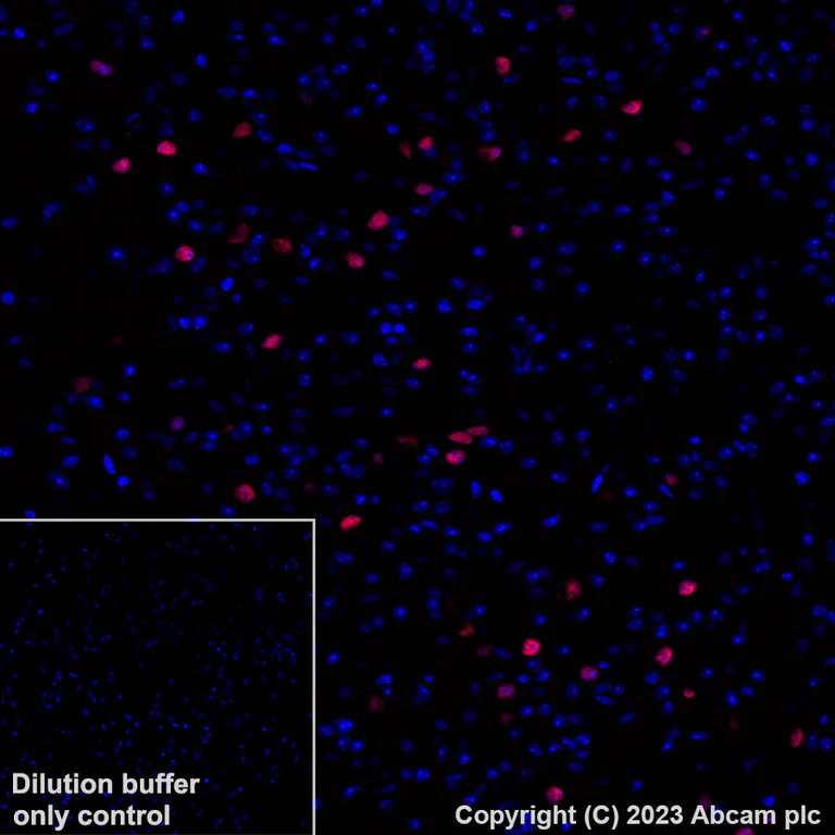 Immunohistochemistry (Formalin/PFA-fixed paraffin-embedded sections) - Alexa Fluor® 647 Anti-FOXP2 antibody [EPR27323-26] (AB314163)