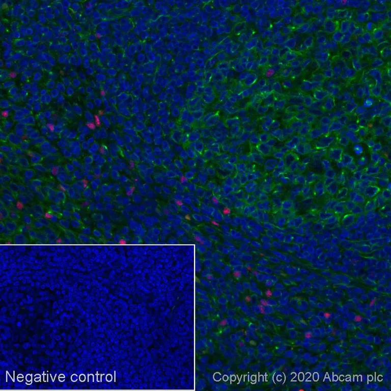 Immunohistochemistry (Formalin/PFA-fixed paraffin-embedded sections) - Alexa Fluor® 647 Anti-FOXP3 antibody [SP97] (AB275079)