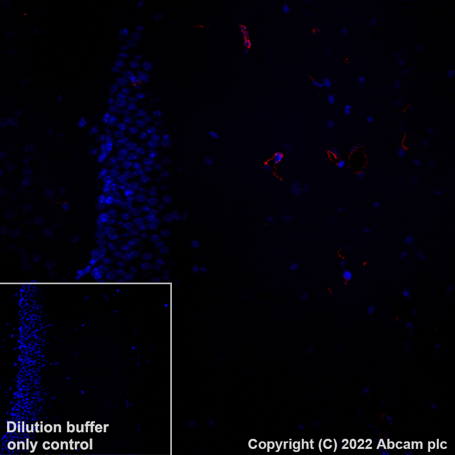 Immunohistochemistry (Formalin/PFA-fixed paraffin-embedded sections) - Alexa Fluor® 647 Anti-Fragilis antibody [EPR26405-14] (AB307345), expandable thumbnail