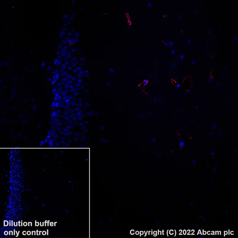 Immunohistochemistry (Formalin/PFA-fixed paraffin-embedded sections) - Alexa Fluor® 647 Anti-Fragilis antibody [EPR26405-14] (AB307345)