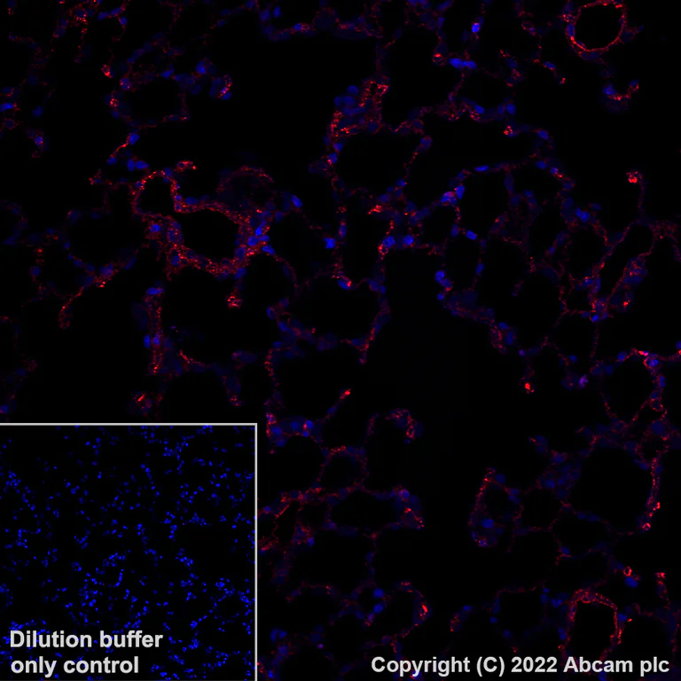 Immunohistochemistry (Formalin/PFA-fixed paraffin-embedded sections) - Alexa Fluor® 647 Anti-Fragilis antibody [EPR26405-14] (AB307345)