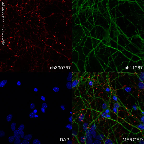 Immunocytochemistry/ Immunofluorescence - Alexa Fluor® 647 Anti-GAD65 antibody [EPR22952-70] (AB300737)