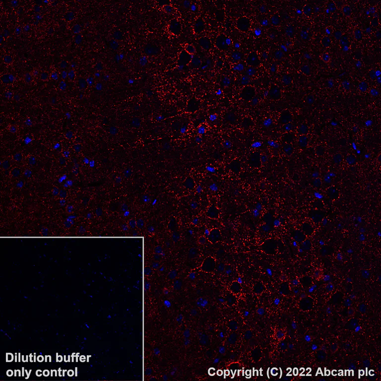 Immunohistochemistry (Formalin/PFA-fixed paraffin-embedded sections) - Alexa Fluor® 647 Anti-GAD67/GAD1 antibody [EPR20578] (AB306597)