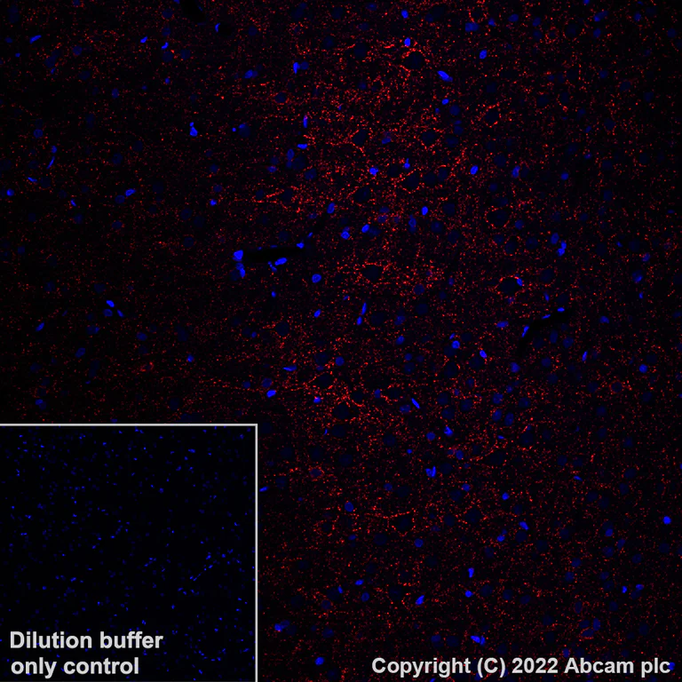 Immunohistochemistry (Formalin/PFA-fixed paraffin-embedded sections) - Alexa Fluor® 647 Anti-GAD67/GAD1 antibody [EPR20578] (AB306597)