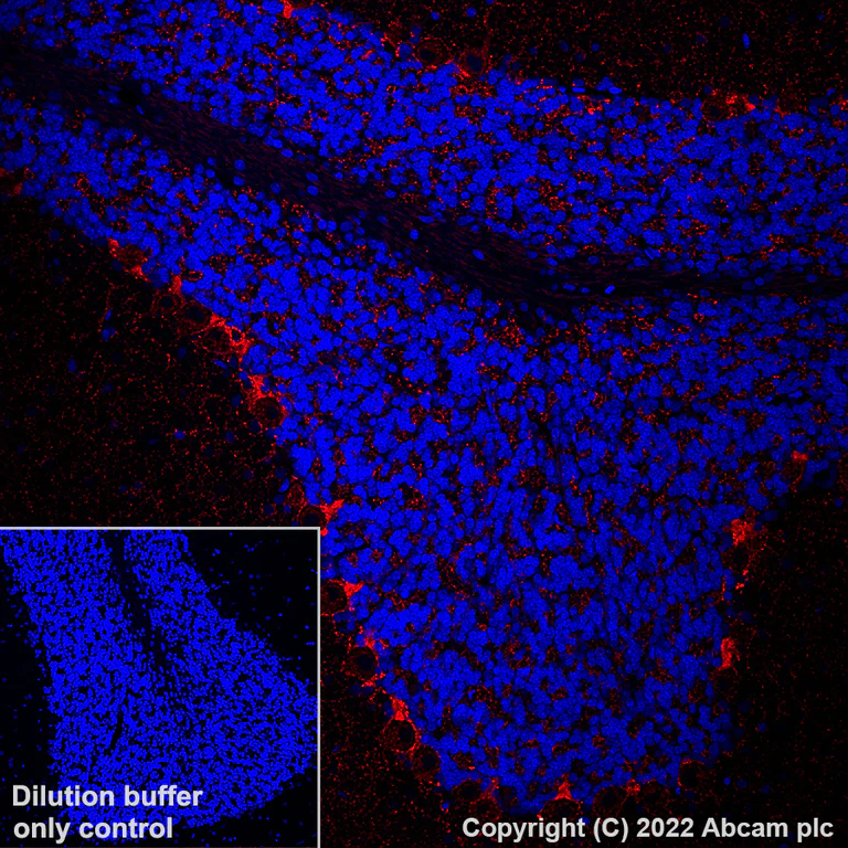 Immunohistochemistry (Formalin/PFA-fixed paraffin-embedded sections) - Alexa Fluor® 647 Anti-GAD67/GAD1 antibody [EPR20578] (AB306597)