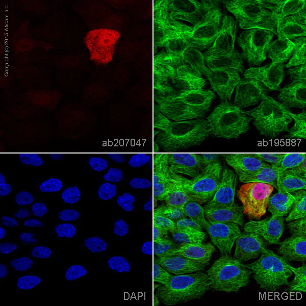 Immunocytochemistry/ Immunofluorescence - Alexa Fluor® 647 Anti-Galectin 7 antibody [EPR4287] (AB207047)