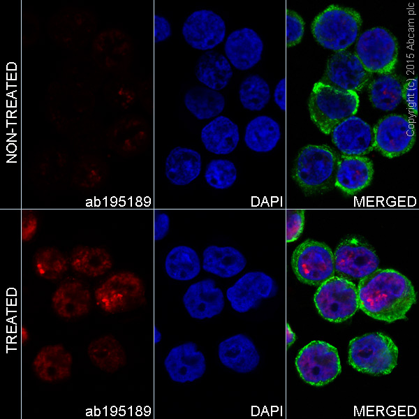 Immunocytochemistry/ Immunofluorescence - Alexa Fluor® 647 Anti-gamma H2A.X (phospho S139) antibody [EP854(2)Y] (AB195189), expandable thumbnail