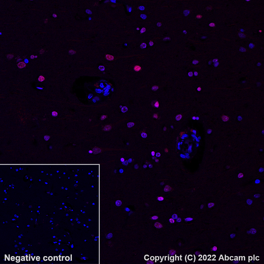 Immunohistochemistry (Formalin/PFA-fixed paraffin-embedded sections) - Alexa Fluor® 647 Anti-gamma H2A.X (phospho S139) antibody [EP854(2)Y] (AB195189), expandable thumbnail