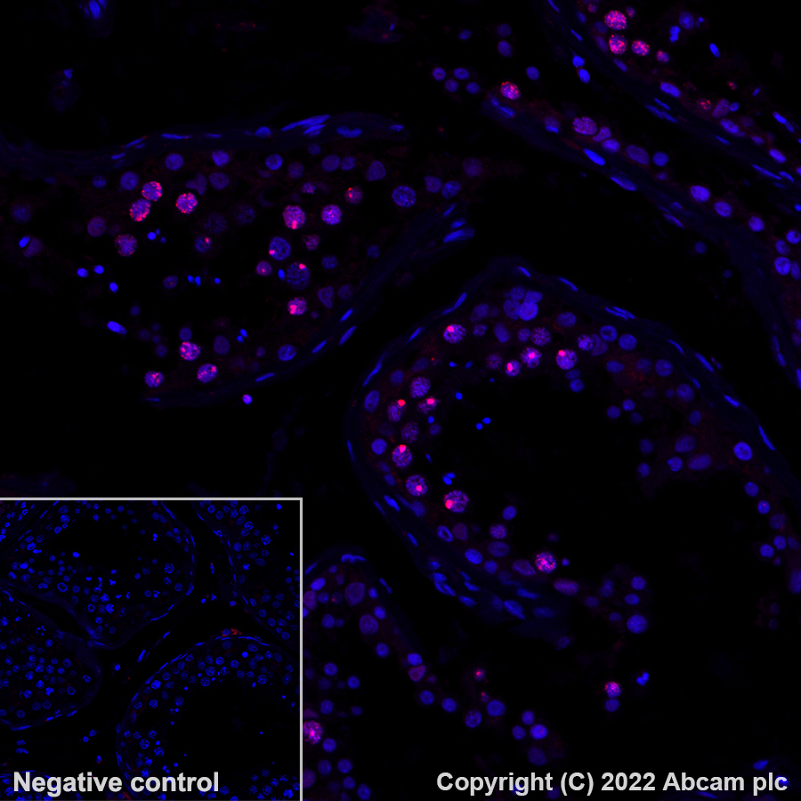 Immunohistochemistry (Formalin/PFA-fixed paraffin-embedded sections) - Alexa Fluor® 647 Anti-gamma H2A.X (phospho S139) antibody [EP854(2)Y] (AB195189), expandable thumbnail