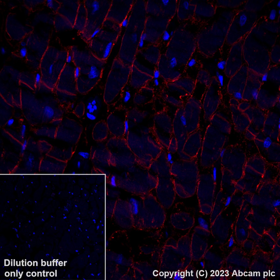 Immunohistochemistry (Formalin/PFA-fixed paraffin-embedded sections) - Alexa Fluor® 647 Anti-gamma Sarcoglycan antibody [EPR17862-7] (AB315257), expandable thumbnail