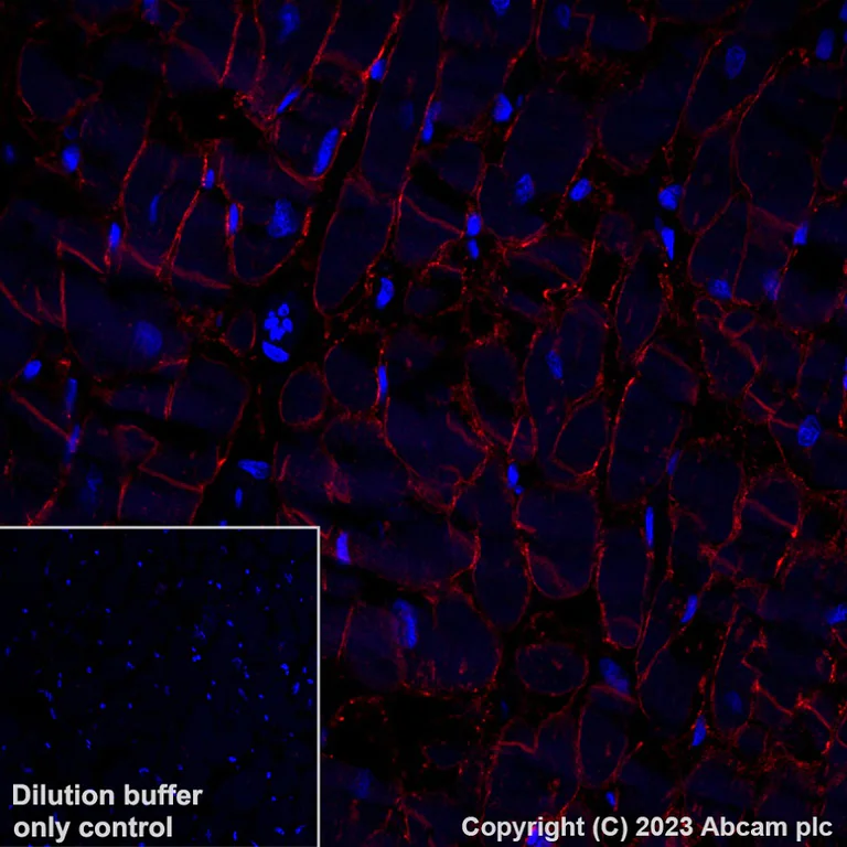 Immunohistochemistry (Formalin/PFA-fixed paraffin-embedded sections) - Alexa Fluor® 647 Anti-gamma Sarcoglycan antibody [EPR17862-7] (AB315257)
