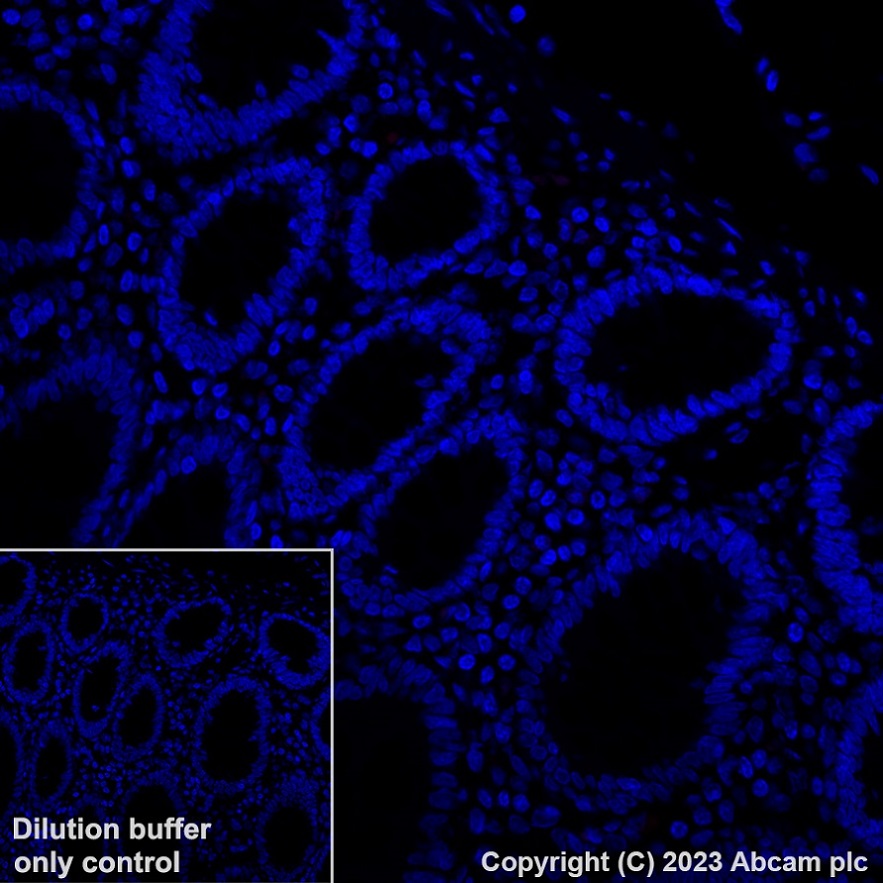 Immunohistochemistry (Formalin/PFA-fixed paraffin-embedded sections) - Alexa Fluor® 647 Anti-gamma Sarcoglycan antibody [EPR17862-7] (AB315257), expandable thumbnail