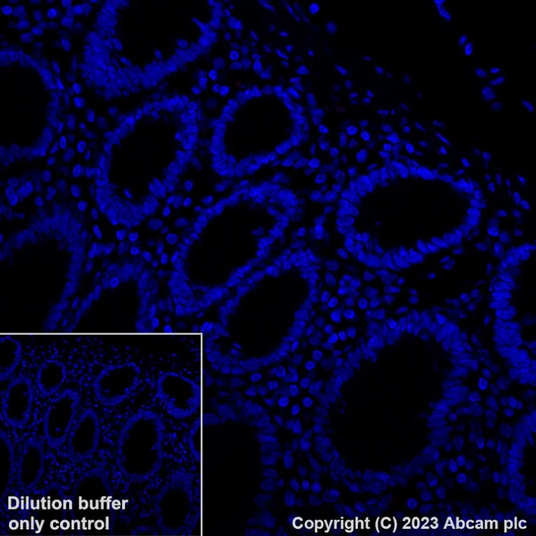 Immunohistochemistry (Formalin/PFA-fixed paraffin-embedded sections) - Alexa Fluor® 647 Anti-gamma Sarcoglycan antibody [EPR17862-7] (AB315257)