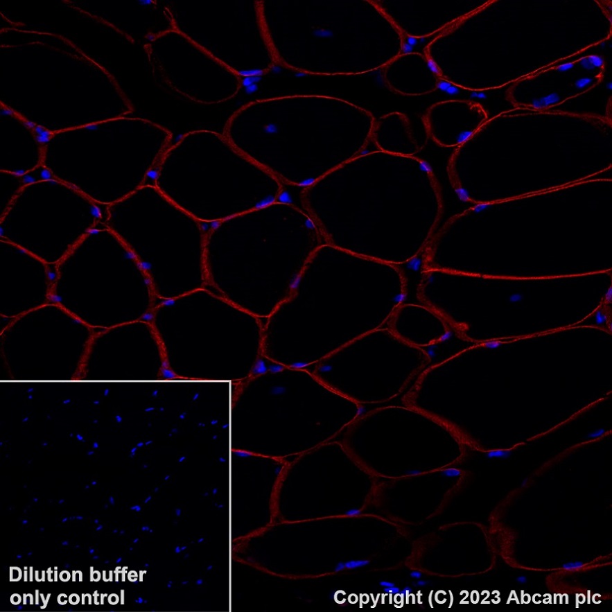 Immunohistochemistry (Formalin/PFA-fixed paraffin-embedded sections) - Alexa Fluor® 647 Anti-gamma Sarcoglycan antibody [EPR17862-7] (AB315257), expandable thumbnail